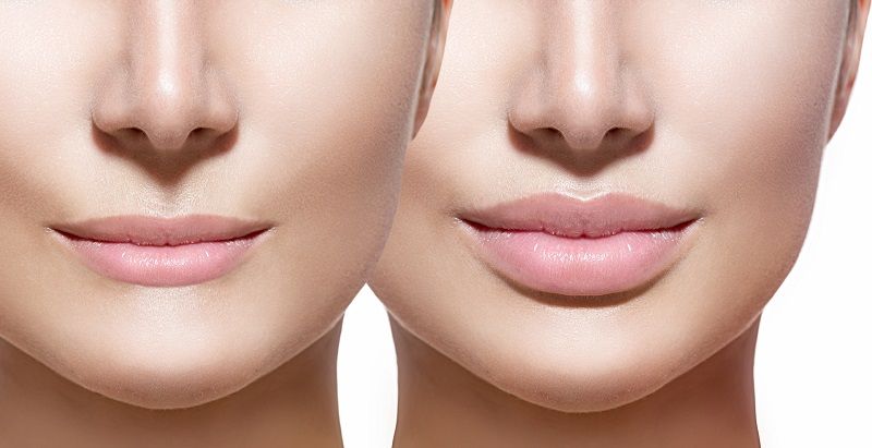 VOLUMINIZADOR DE LABIOS KISS BEAUTY 💋 ENVÍO GRATIS
